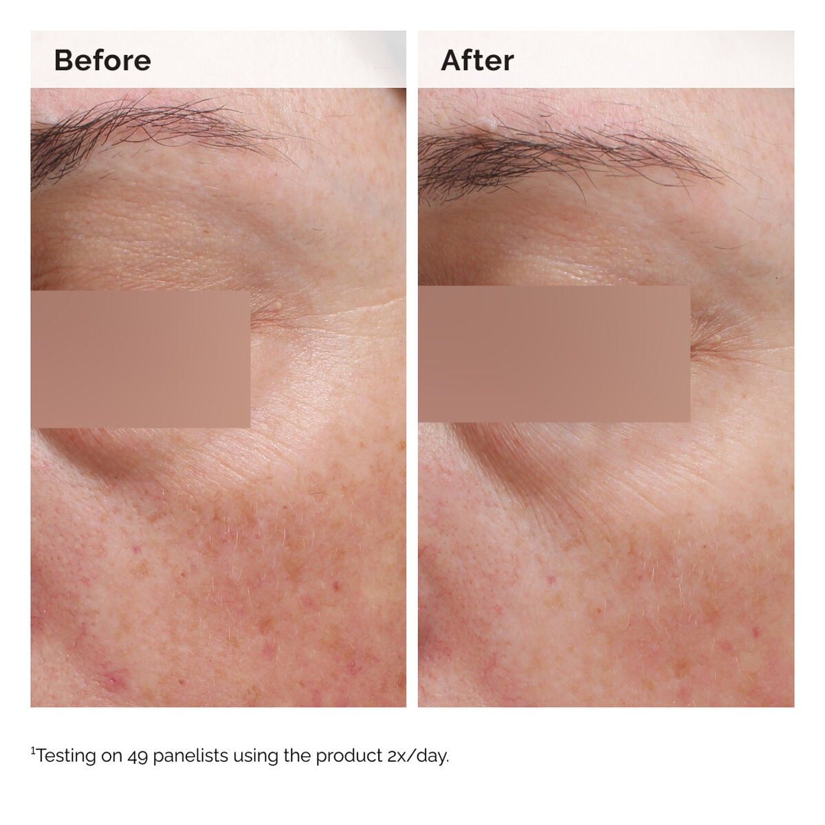 niacinamide-5-face-and-body-emulsion-p5 2024-08-23-ORD-Nia-5pct-Face-Body-B-A-Elasticity-Global-02-1x1.jpg