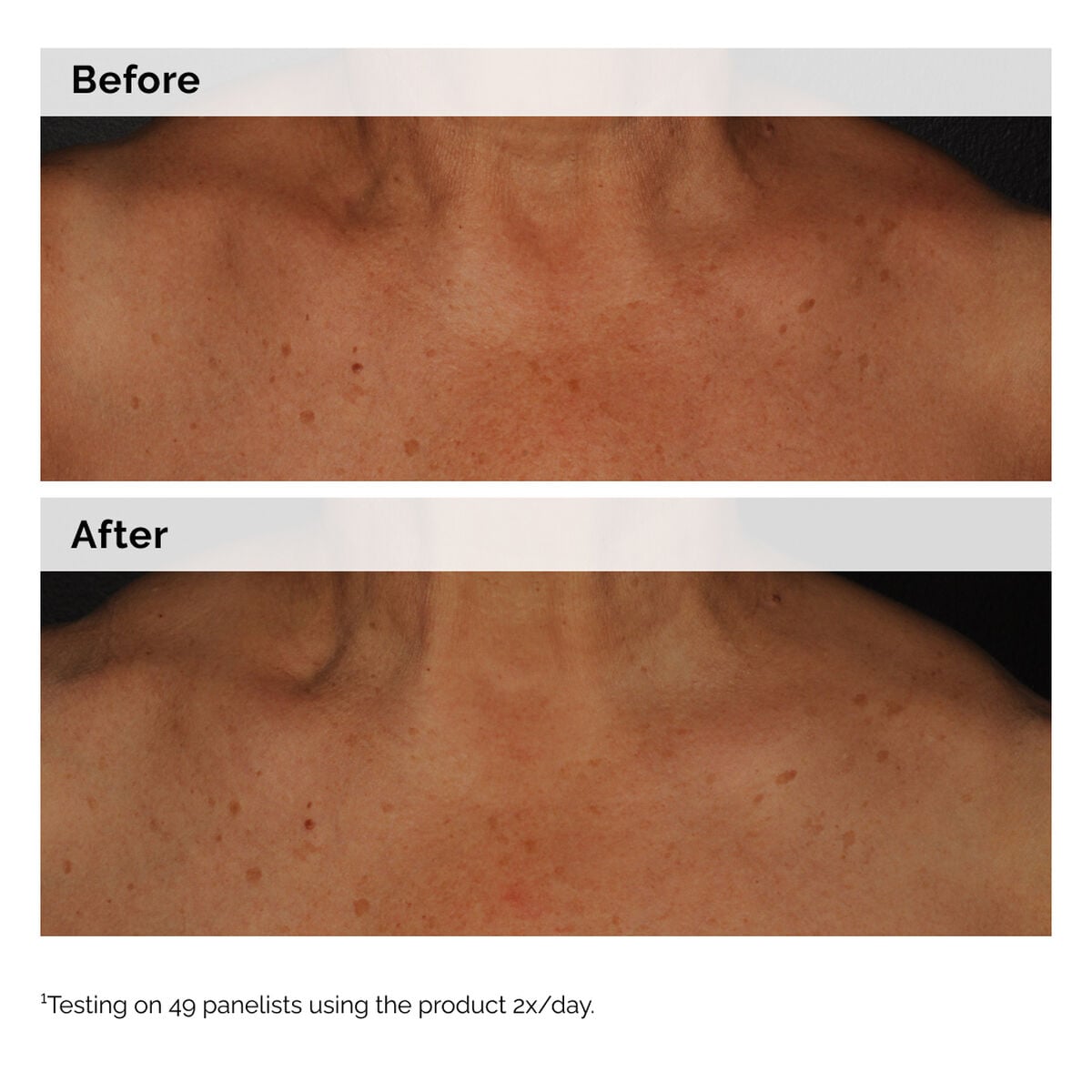 niacinamide-5-face-and-body-emulsion-p5 2024-08-23-ORD-Nia-5pct-Face-Body-B-A-Global-02-1x1.jpg