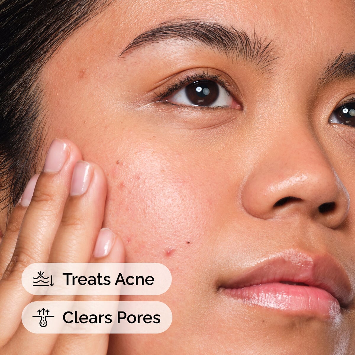 salicylic-acid-2-solution-b2 FY25-D41247-ORD-Web-SA-Sltn-1x1-CA-US-EN-4d.jpg
