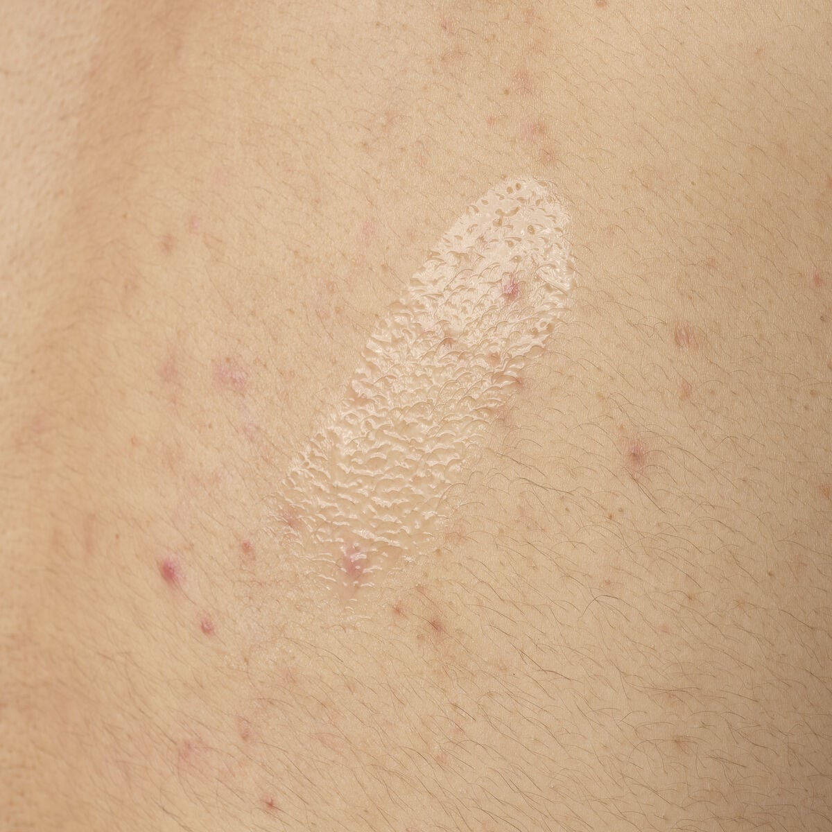 salicylic-acid-0-5-body-serum-z6 ORD-salicylic-acid-05-body-240ml-application.jpg