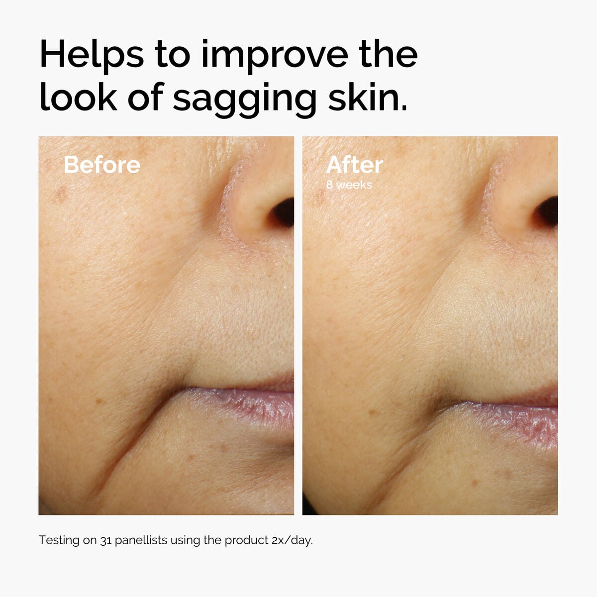 caffeine-3-escin-1-face-serum-e5 ord-caffeine-3pct-escin-1pct-face-serum-before-after-sagging.jpg