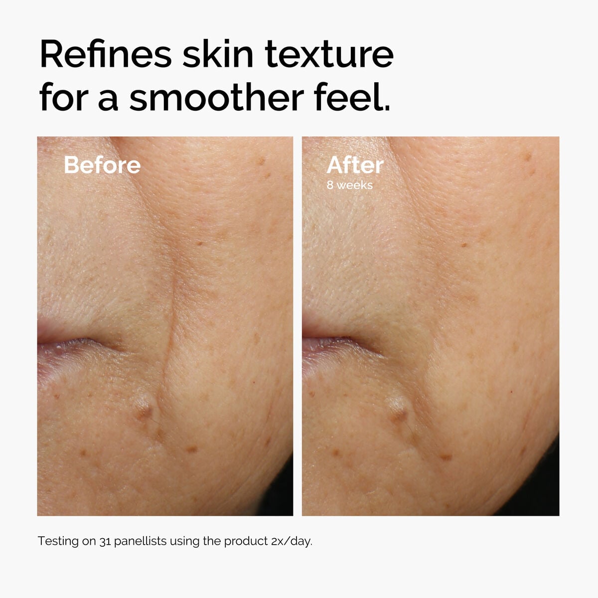 caffeine-3-escin-1-face-serum-e5 ord-caffeine-3pct-escin-1pct-face-serum-before-after-texture.jpg