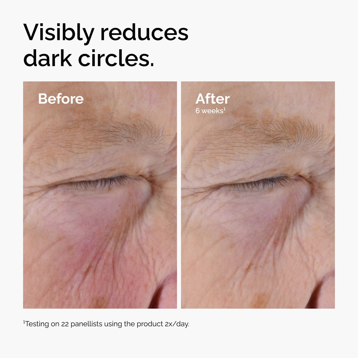caffeine-solution-5-egcg-eye-serum-l2 ord-caffeine-solution-egcg-dark-circles-before-after.jpg