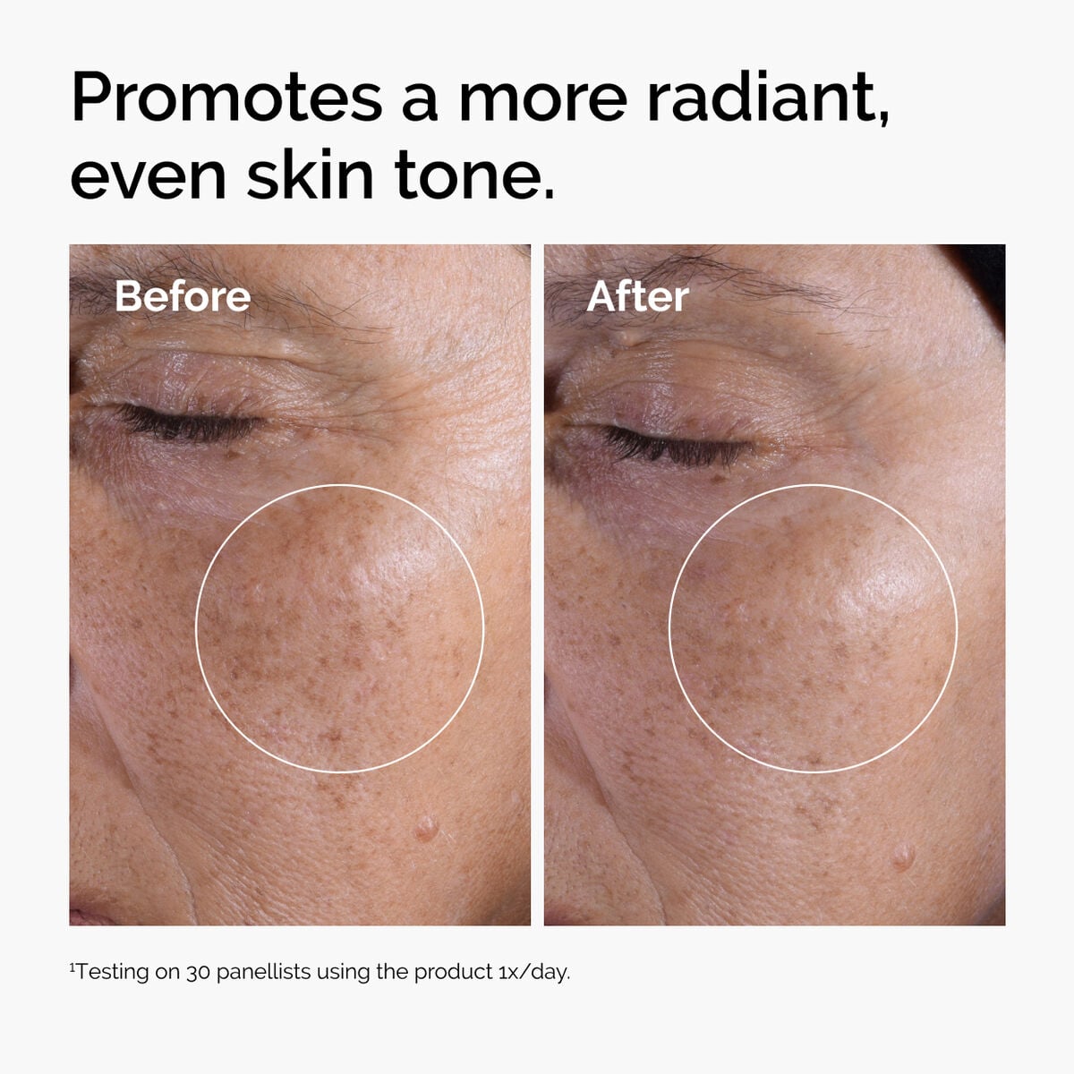 glycolic-acid-7-exfoliating-toner-x4 ord-glycolic-before-after-radiance.jpg