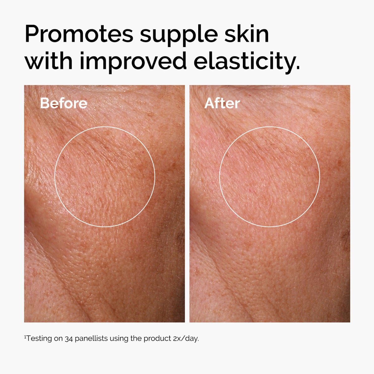 hyaluronic-acid-2-b5-with-ceramides-m1 ord-hyaluronic-acid-2pct-b5-hydrating-serum-before-after-elasticity.jpg