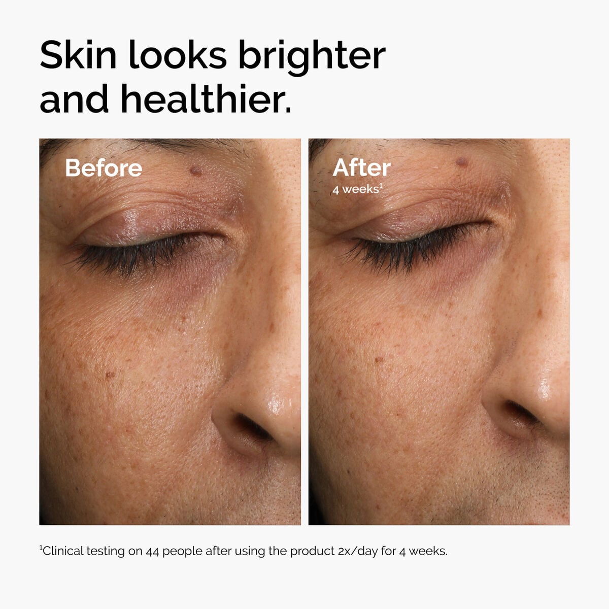 multi-antioxidant-radiance-serum-l8 ord-mars-before-after-healthy.jpg