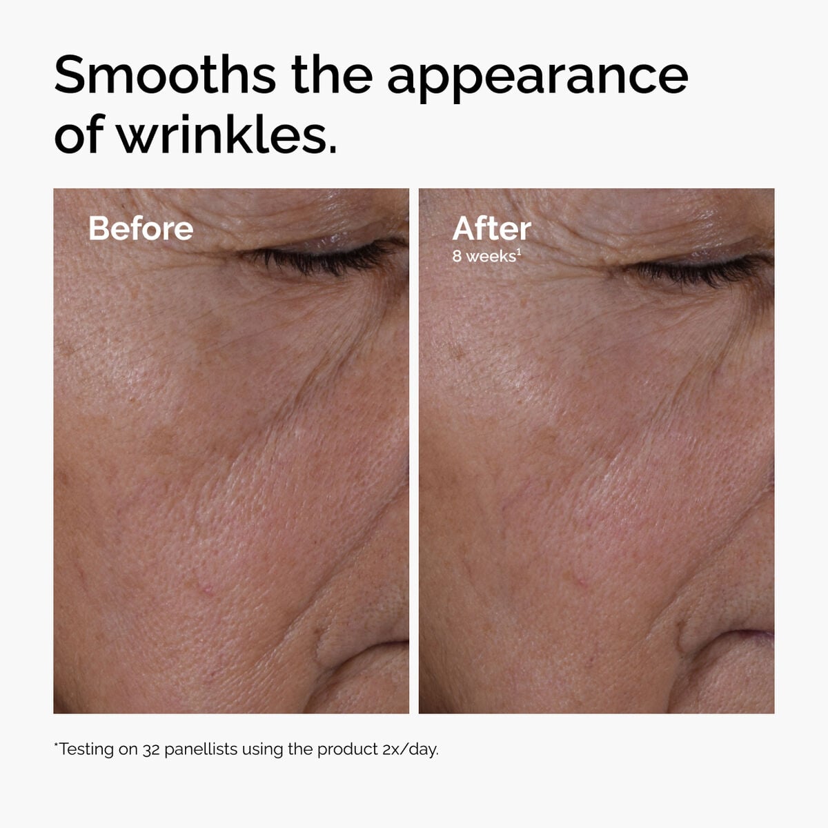 multi-peptide-ha-serum-p8 ord-multi-peptide-ha-serum-wrinkles-before-after.jpg