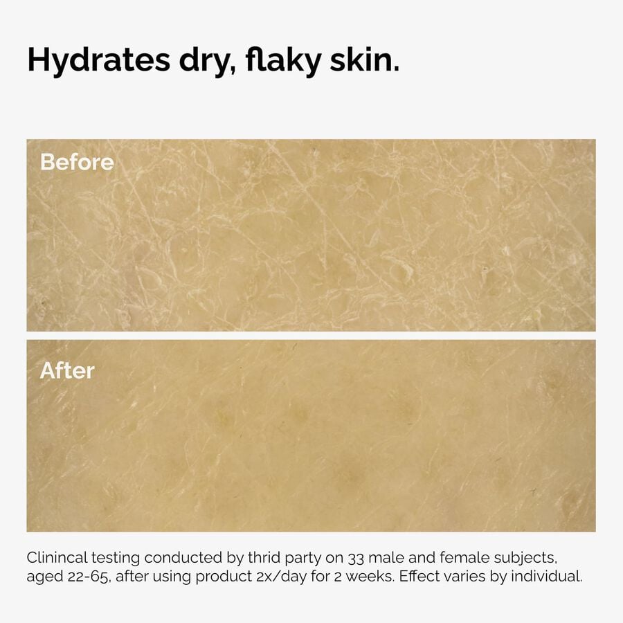 the-body-care-collection-g1 ord-natural-moisturizing-factors-inulin-body-before-after-graphic-02.jpg