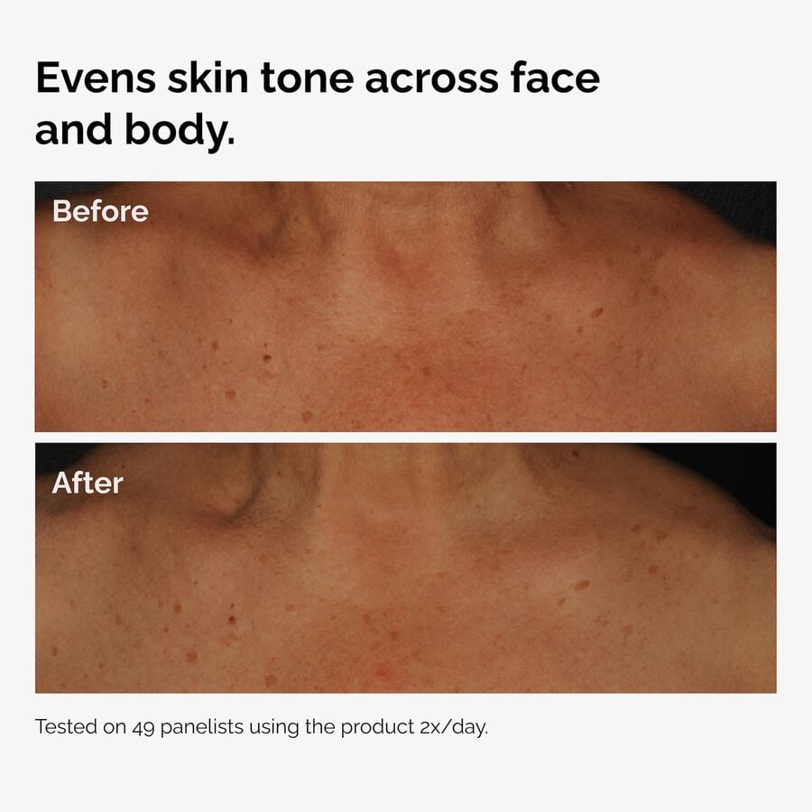 the-body-care-collection-g1 ord-niacinamide-face-body-serum-before-after-even-tone-graphic.jpg