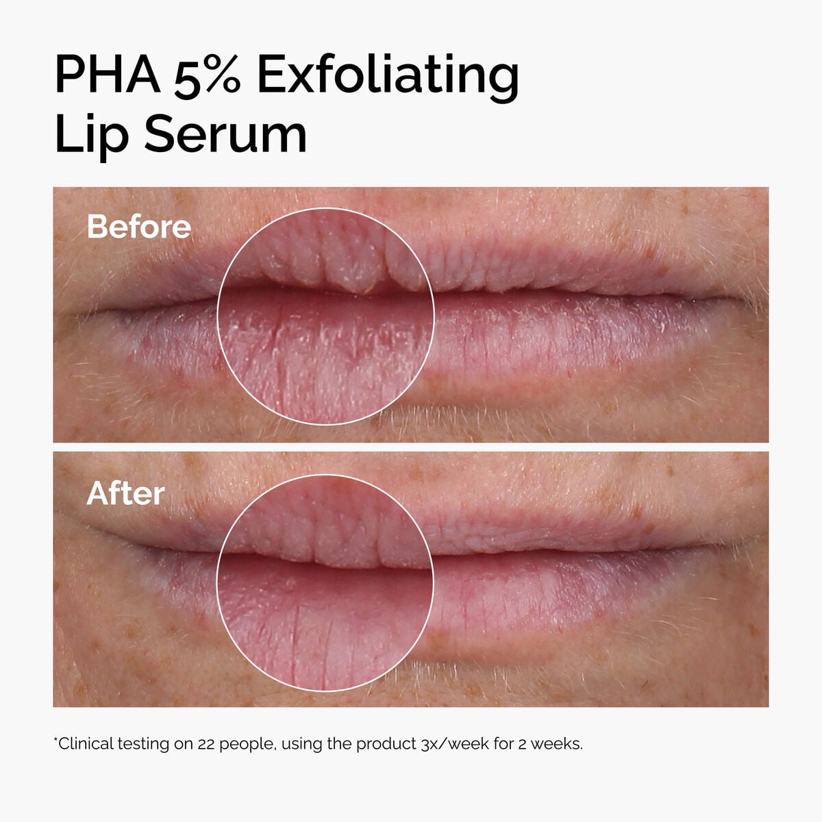 pha-5-exfoliating-lip-serum-k0 ord-pha-5pct-lip-exfoliating-serum-before-after.jpg