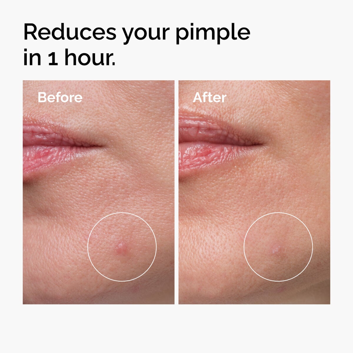 sulfur-10-powder-to-cream-concentrate-r7 ord-sulfur-10pct-powder-to-cream-concentrate-before-after-NA.jpg